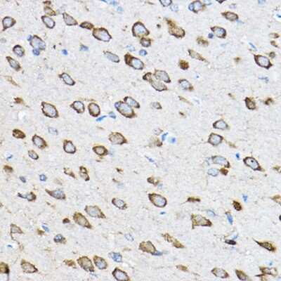 Immunohistochemistry-Paraffin: 60S ribosomal protein L23 Antibody - BSA Free [NBP2-92441]