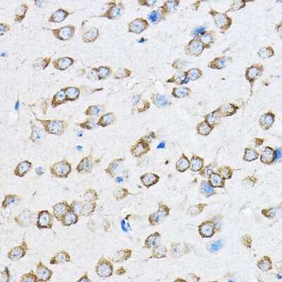 Immunohistochemistry-Paraffin: 60S ribosomal protein L23 Antibody - BSA Free [NBP2-92441]