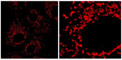 Applications on Mitochondria for Janelia Fluor&#174; 635, NHS ester