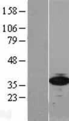 Western Blot: RPSA Overexpression Lysate [NBL1-15578]