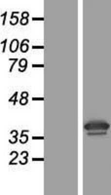 Western Blot: RPSA Overexpression Lysate [NBL1-15579]