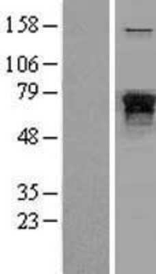 Western Blot: NF-L Overexpression Lysate [NBL1-13577]