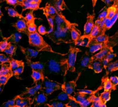 Immunocytochemistry/ Immunofluorescence: 7-Ketocholesterol Antibody (3F7) [NBP2-59357]