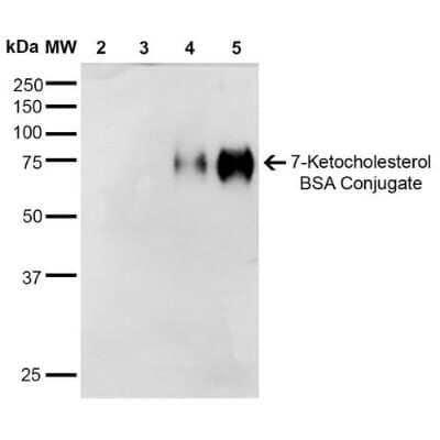 Western Blot: 7-Ketocholesterol Antibody (3F7) [NBP2-59357]