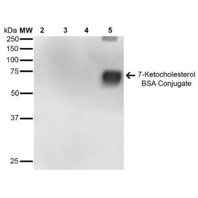 Western Blot: 7-Ketocholesterol Antibody (7E1) [NBP2-59356]