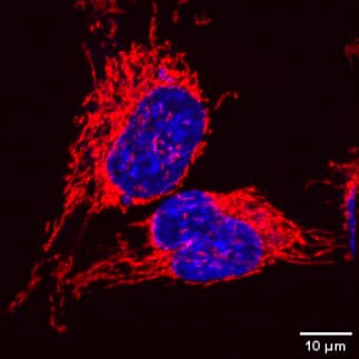 High resolution confocal image of MitoBrilliant Live 646 revealed the morphology of mitochondria in live cell