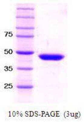 SDS-PAGE: Recombinant Human SETD7/9 Protein [NBC1-18444]