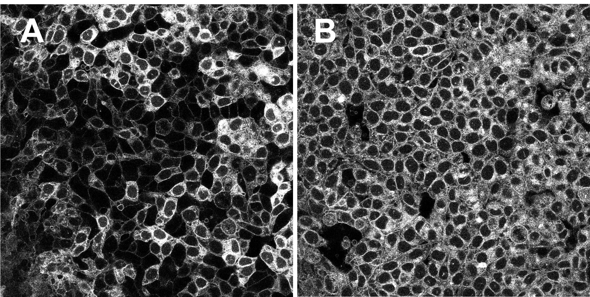 Application of CELT-327 to fixed colorectal cancer cells.