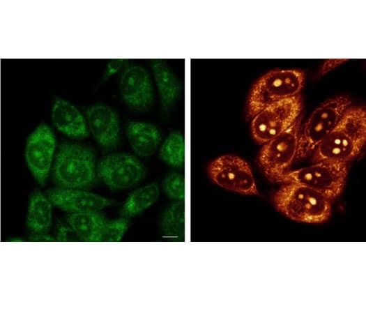 Live HeLa cells labeled with RNA Imaging Probe 1c