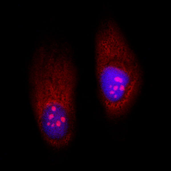DAPI counterstaining alongside RNA Imaging Probe 1c on HeLa cells