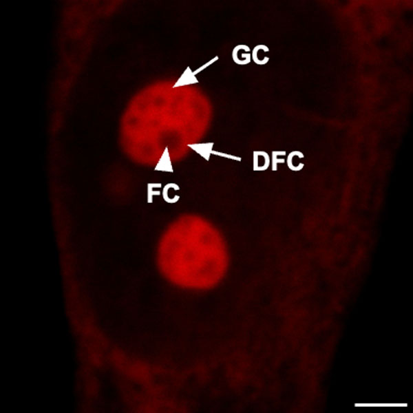 HeLa cells stained with RNA Imaging Probe 1c