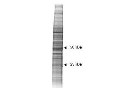 Western Blot: A-431 Whole Cell Lysate [NB800-PC12]