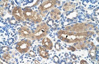 Immunohistochemistry: A-Myb Antibody [NBP2-86995]