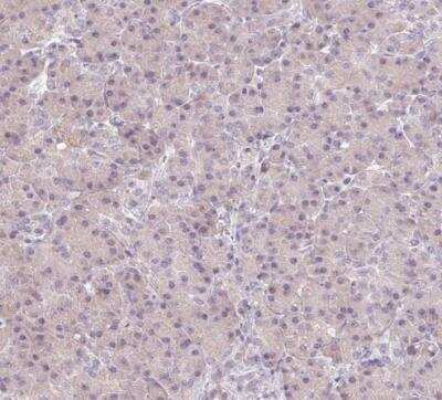 Immunohistochemistry-Paraffin: A-Myb Antibody [NBP1-90171]