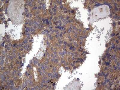 Immunohistochemistry: A-RAF Antibody (OTI2G9) [NBP2-46538]