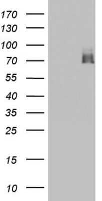 Western Blot: A-RAF Antibody (OTI2G9) [NBP2-46538]