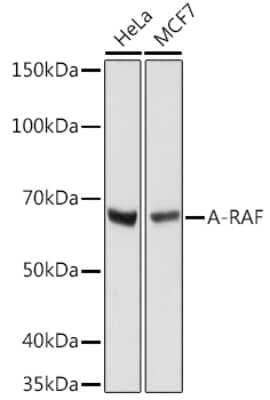 Western Blot: A-RAF Antibody (4U9L7) [NBP3-16677]