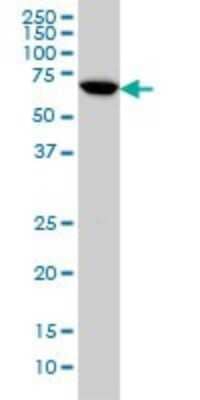 Western Blot: A-RAF Antibody (5H8) [H00000369-M02]