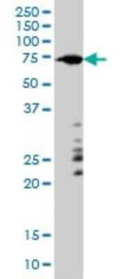 Western Blot: A-RAF Antibody (6H6) [H00000369-M01]