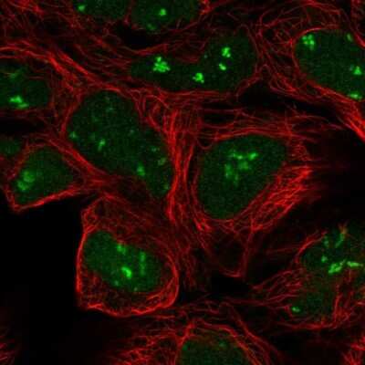 Immunocytochemistry/ Immunofluorescence: A-RAF Antibody [NBP2-55054]