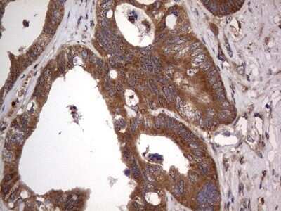 Immunohistochemistry: A-RAF Antibody (OTI2G9) - Azide and BSA Free [NBP2-70201]
