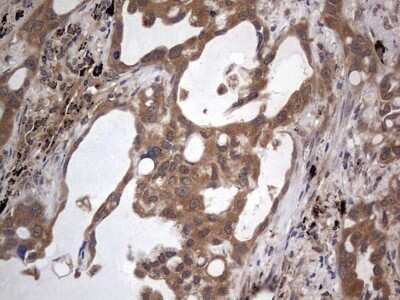 Immunohistochemistry: A-RAF Antibody (OTI2G9) - Azide and BSA Free [NBP2-70201]