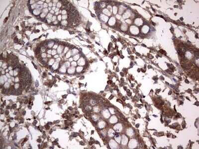 Immunohistochemistry: A-RAF Antibody (OTI2G9) - Azide and BSA Free [NBP2-70201]
