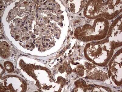 Immunohistochemistry: A-RAF Antibody (OTI2G9) - Azide and BSA Free [NBP2-70201]