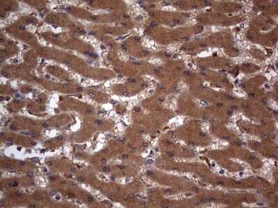 Immunohistochemistry: A-RAF Antibody (OTI2G9) - Azide and BSA Free [NBP2-70201]