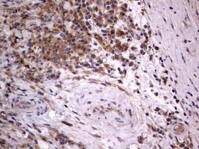 Immunohistochemistry: A-RAF Antibody (OTI2G9) - Azide and BSA Free [NBP2-70201]