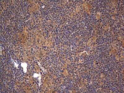 Immunohistochemistry: A-RAF Antibody (OTI2G9) - Azide and BSA Free [NBP2-70201]