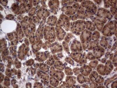 Immunohistochemistry: A-RAF Antibody (OTI2G9) - Azide and BSA Free [NBP2-70201]