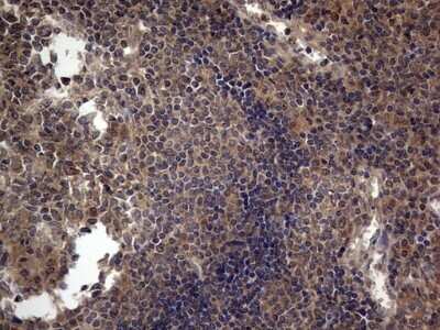 Immunohistochemistry: A-RAF Antibody (OTI2G9) - Azide and BSA Free [NBP2-70201]