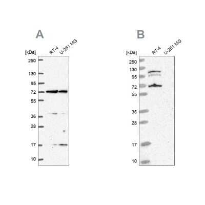 Western Blot: A-RAF Antibody [NBP2-49479]