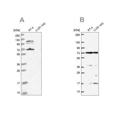 Western Blot: A-RAF Antibody [NBP2-55054]