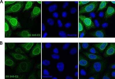 Immunocytochemistry/ Immunofluorescence: A. aeolicus BPL/BioID2 Antibody (SS 3A5-E2) - BSA Free [NBP2-59941]