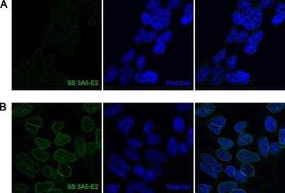 Immunocytochemistry/ Immunofluorescence: A. aeolicus BPL/BioID2 Antibody (SS 3A5-E2) - BSA Free [NBP2-59941]
