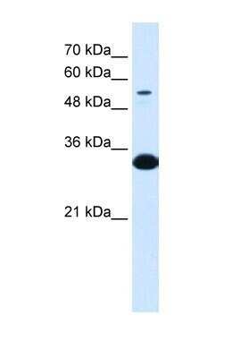 Alpha 1B-Glycoprotein Antibody (NBP1-57965) By Novus, Part Of Bio-Techne