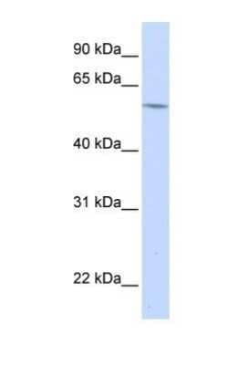 Western Blot: alpha 1B-Glycoprotein Antibody [NBP1-57969]