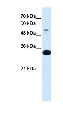 Western Blot: alpha 1B-Glycoprotein Antibody [NBP1-57969]