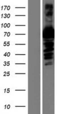 Western Blot: alpha 1B-Glycoprotein Overexpression Lysate [NBP2-05737]