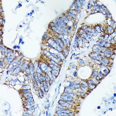 Immunohistochemistry-Paraffin: A20/TNFAIP3 Antibody (0K8B0) [NBP3-15681]