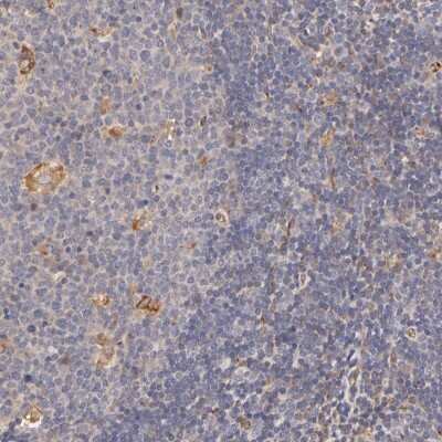 Immunohistochemistry-Paraffin: A20/TNFAIP3 Antibody [NBP1-89337]