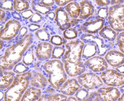Immunohistochemistry-Paraffin: A20/TNFAIP3 Antibody (SN07-31) [NBP2-67676]