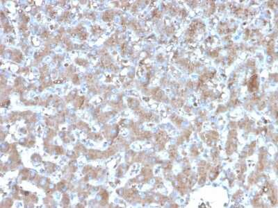 Immunohistochemistry-Paraffin: A20/TNFAIP3 Antibody (TNFAIP3/2813) - Azide and BSA Free [NBP3-08733]