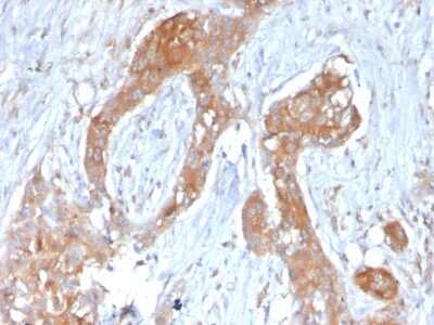 Immunohistochemistry-Paraffin: A20/TNFAIP3 Antibody (TNFAIP3/2813) - Azide and BSA Free [NBP3-08733]