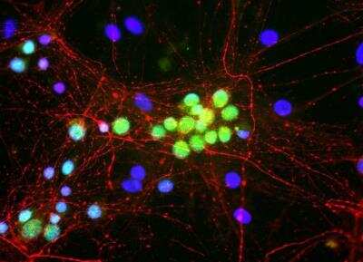 Immunocytochemistry/ Immunofluorescence: A2BP1 Antibody (1G10) [NBP3-11943]