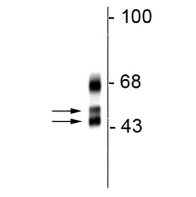 Western Blot: A2BP1 Antibody (1G10) [NBP3-11943]