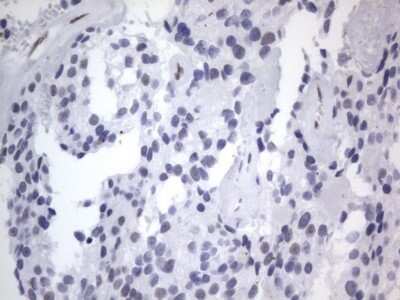 Immunohistochemistry: A2BP1 Antibody (OTI4F9) [NBP2-45532]