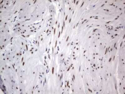 Immunohistochemistry: A2BP1 Antibody (OTI4F9) [NBP2-45532]